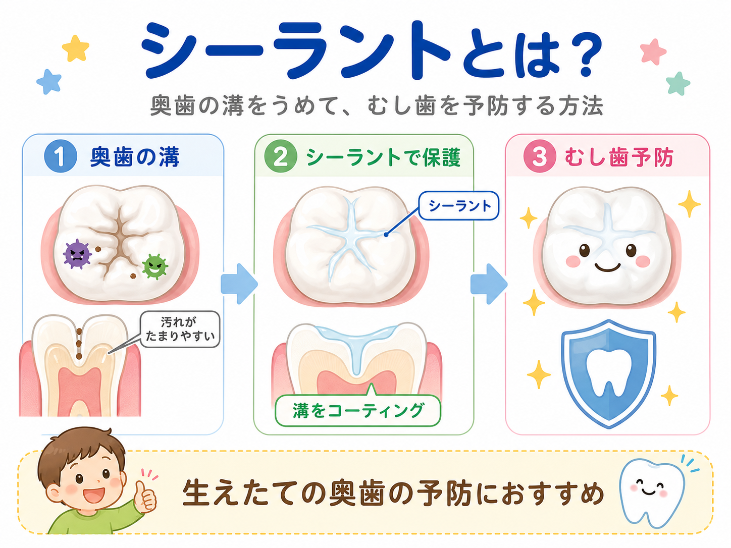 シーラント
